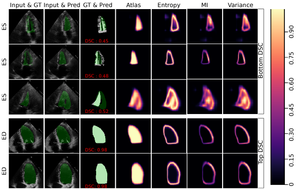 Uncertainty Estimation in Semantic Segmentation of US Images