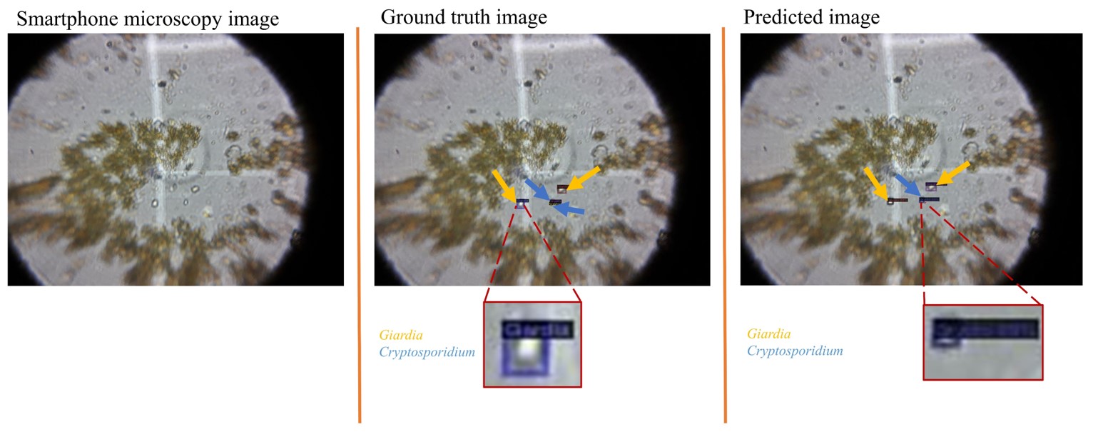 AI-Assisted Smartphone Microscopy