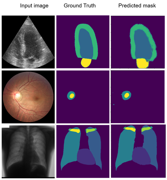 Semi-Supervised Semantic Image Segmentation