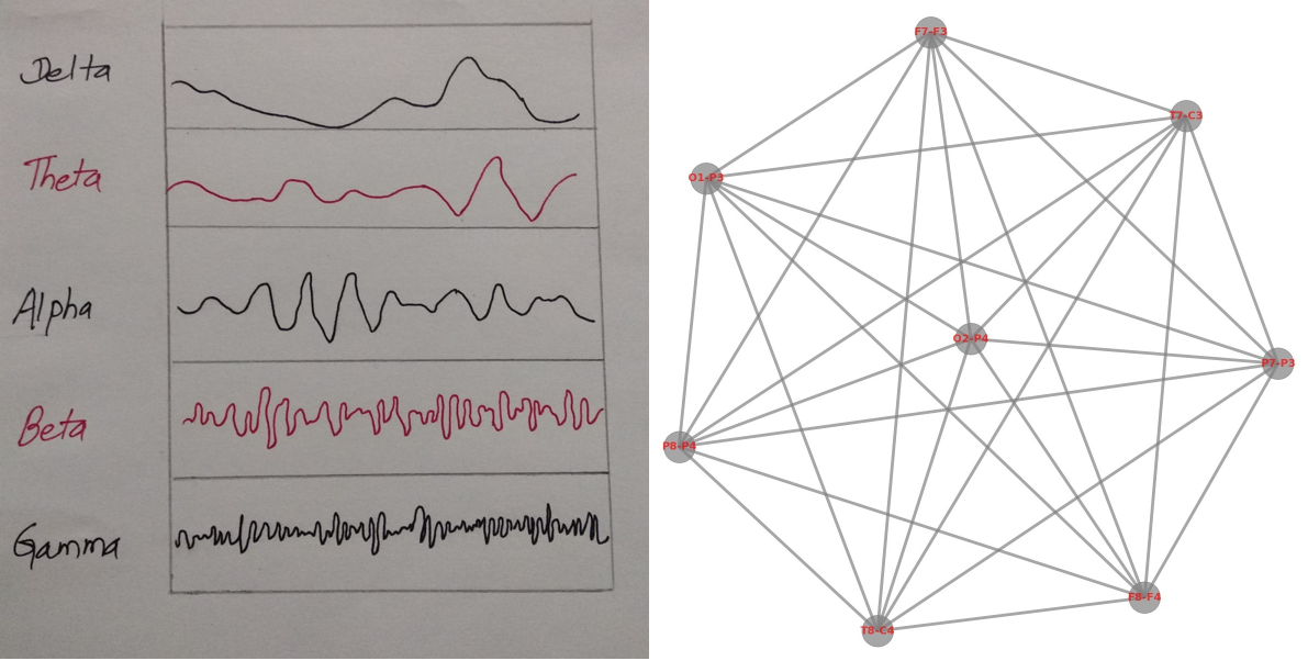 Geometric deep learning on graphs for electroencephalogram dataset